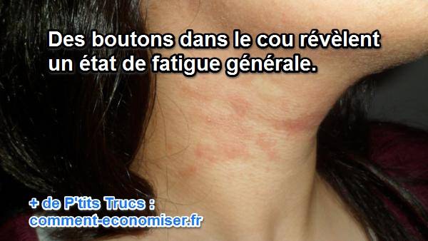 Fait mal le ventre devant mensuel et fait mal le dos