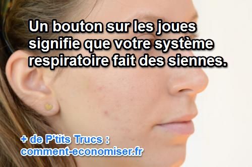 Les masques pour la personne pour les adolescents sur les points noirs
