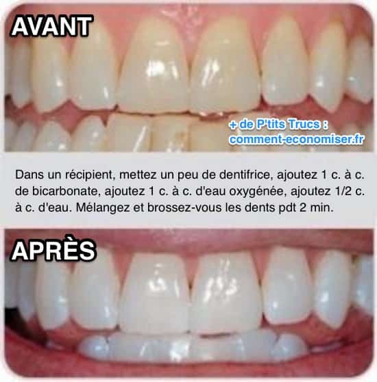 Comment Faire Le Floss