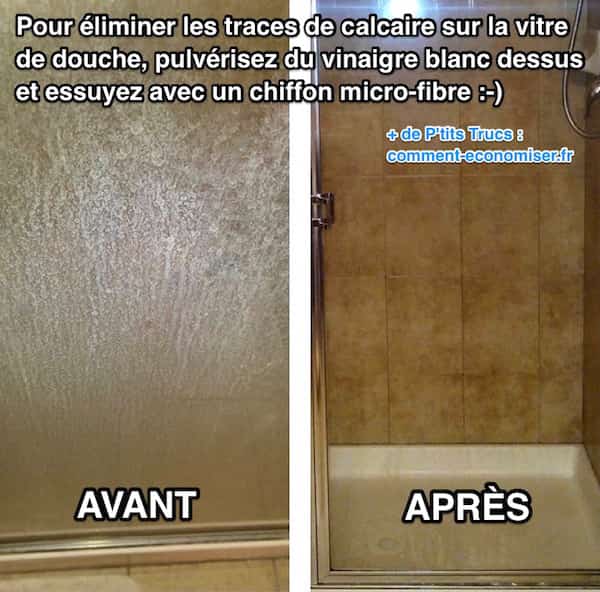Lastérisque vasculeux comme guérir