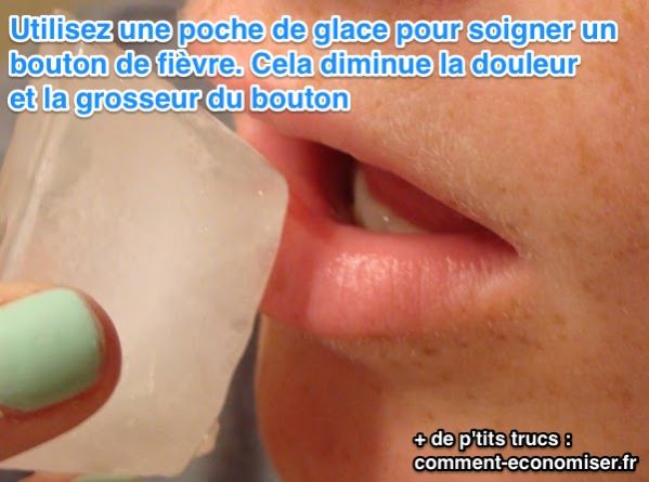 comment guerir un bouton de fievre rapidement