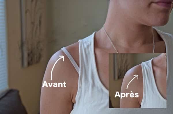 Closecret Extensions De Bretelles De Soutien-gorge Pour Femme