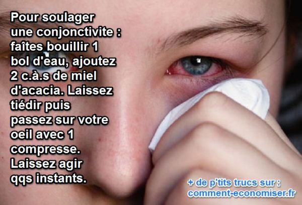 " Le Petit Journal Quotidien " Maria21 - Page 12 Astuce-conjonctivite-miel_600x408