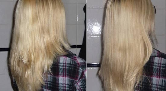 Blanchir les taches de rousseur de leau oxygénée