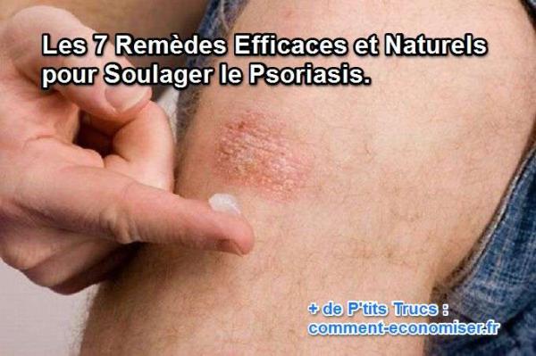 " Santé Au Naturel " Remede-efficace-soigner-psoriasis