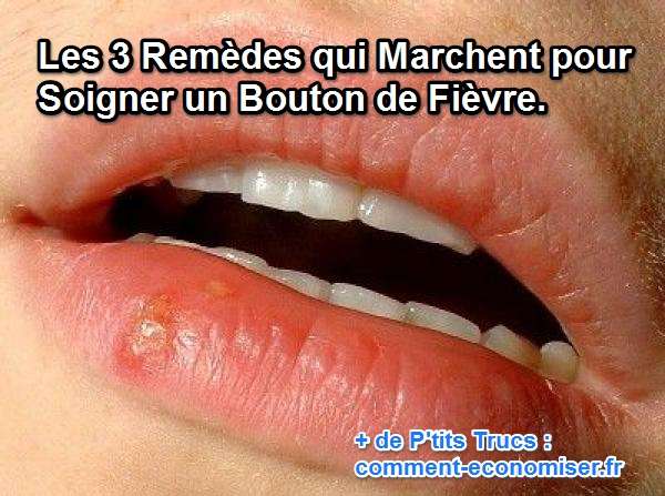 Les 3 Remèdes qui Marchent pour Soigner un Bouton de Fièvre. Les 3 Remèdes qui Marchent pour Soigner un Bouton de Fièvre.